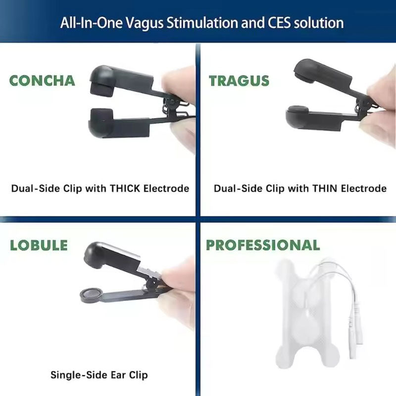 Neurological stimulation electrode ear clips are suitable for TENS medical